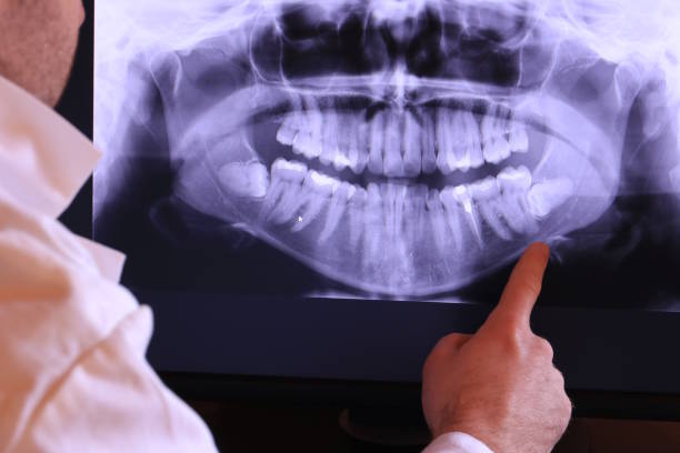 Best Weekend Emergency Dentist in Cedar Creek, TX