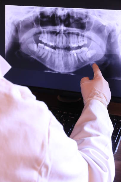 Best Emergency Dental Care for Abscessed Tooth in Cedar Creek, TX
