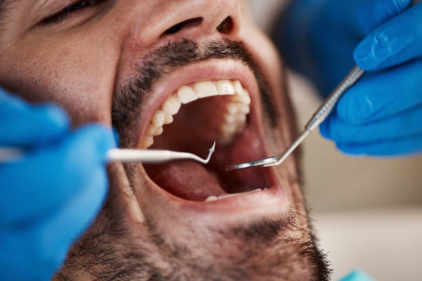 Best Mobile Emergency Dentist in Cedar Creek, TX