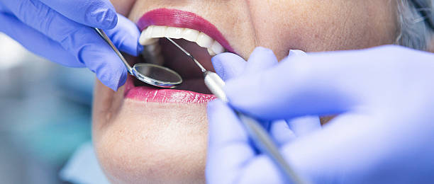 Best Emergency Dentist for Lost Fillings or Crowns in Cedar Creek, TX